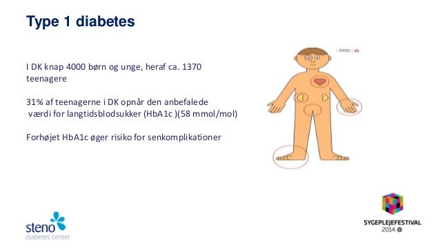 senkomplikationer diabetes type 2 senkomplikationer diabetes type 2